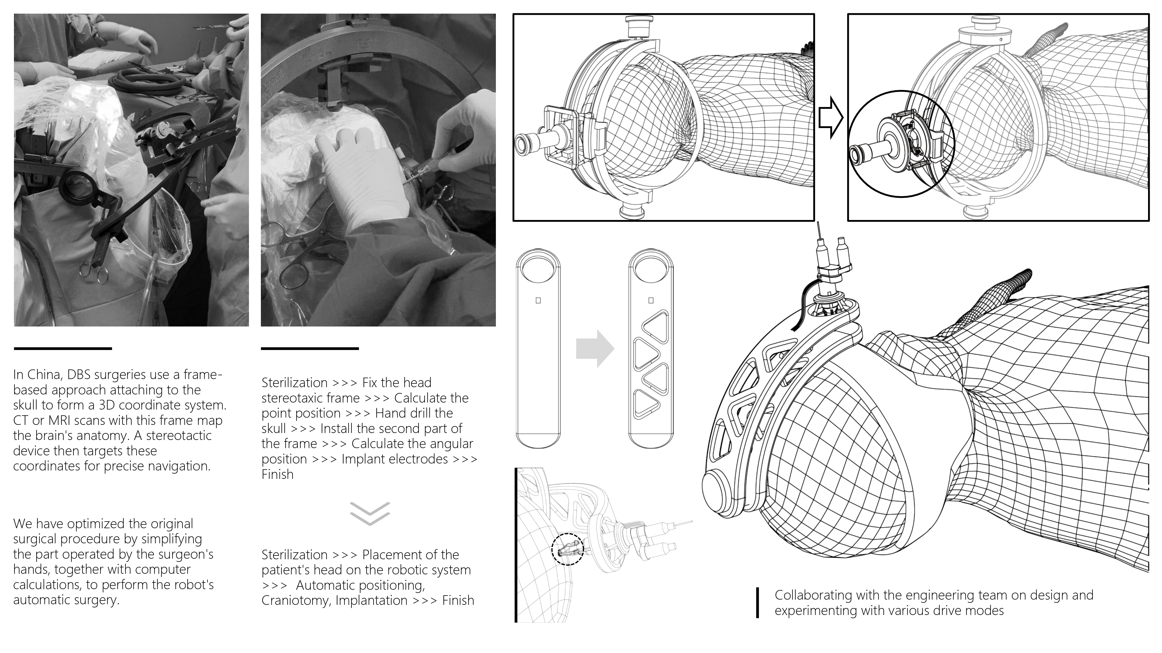 DBS project rendering 2