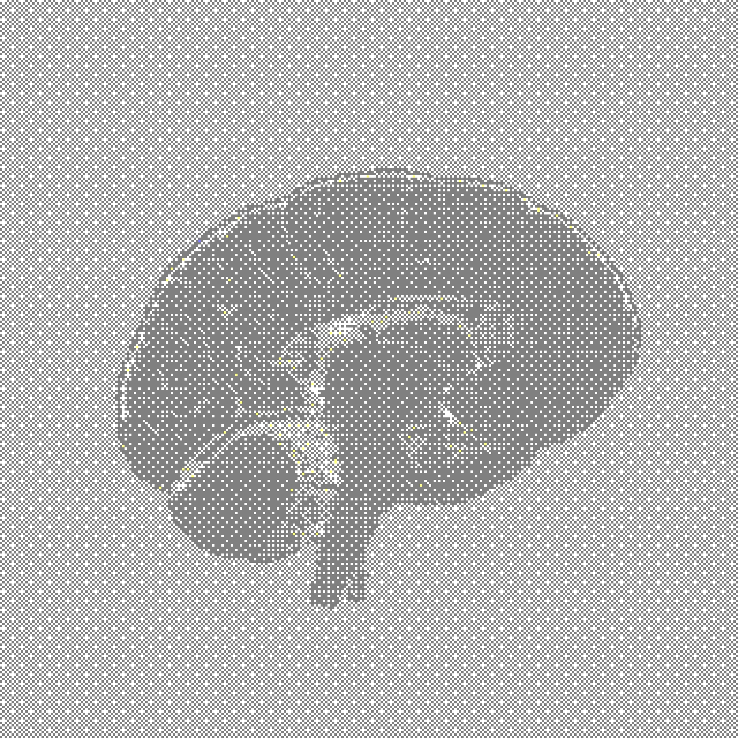 Visualizing Finger Therapy neurological impact